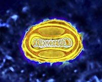 An enhanced photo of the variola virus, which causes smallpox.