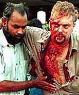 A bloody victim of the Sheraton Hotel bombing.
